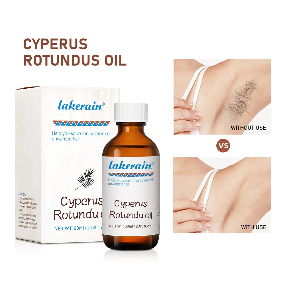 Semi-permanent Cyperus Rotundus Oil Hair Remover Armpit Legs Arms Hair Growth Inhibitor Beauty Skin Care Body Essential Oil