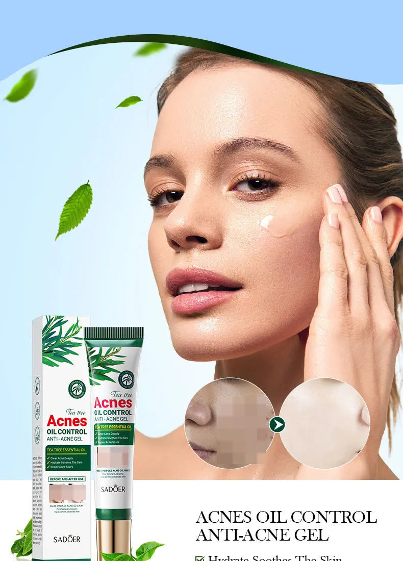 SADOER Tea Tree Acne Removing Cream Facial Skincare Oil Control Face Gel Creams Hydrating Moisturizing Facial Cream Skin Care