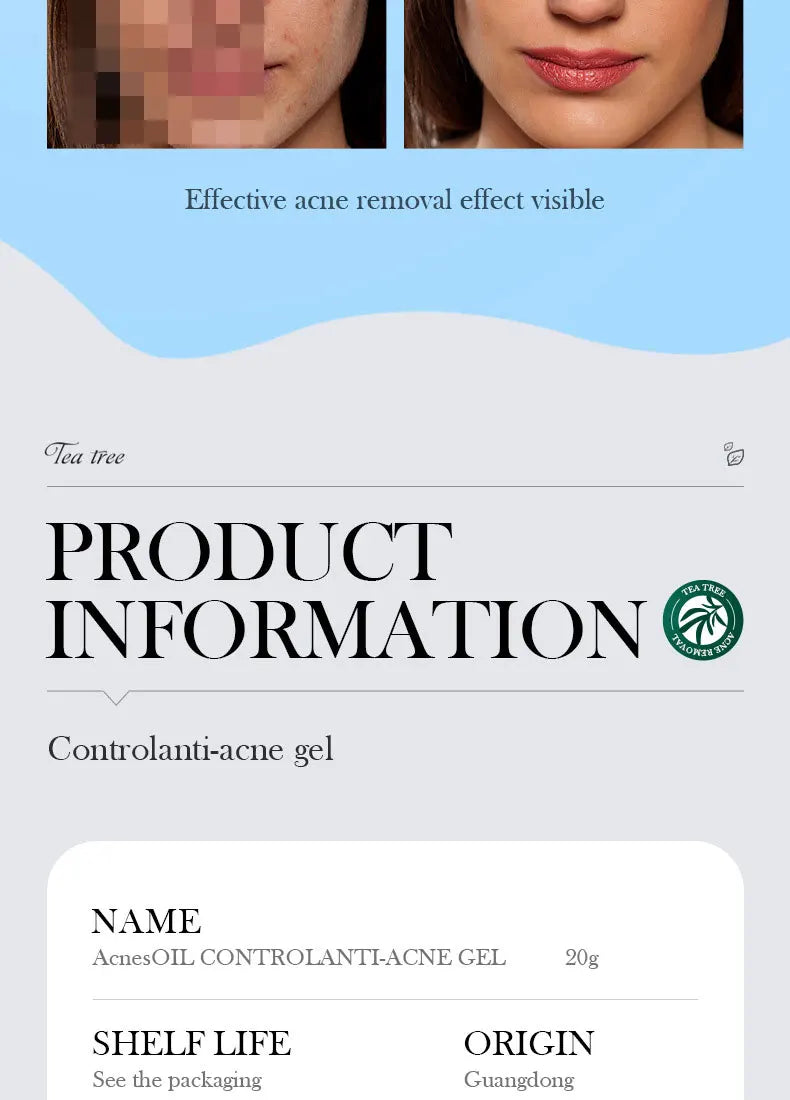 SADOER Tea Tree Acne Removing Cream Facial Skincare Oil Control Face Gel Creams Hydrating Moisturizing Facial Cream Skin Care