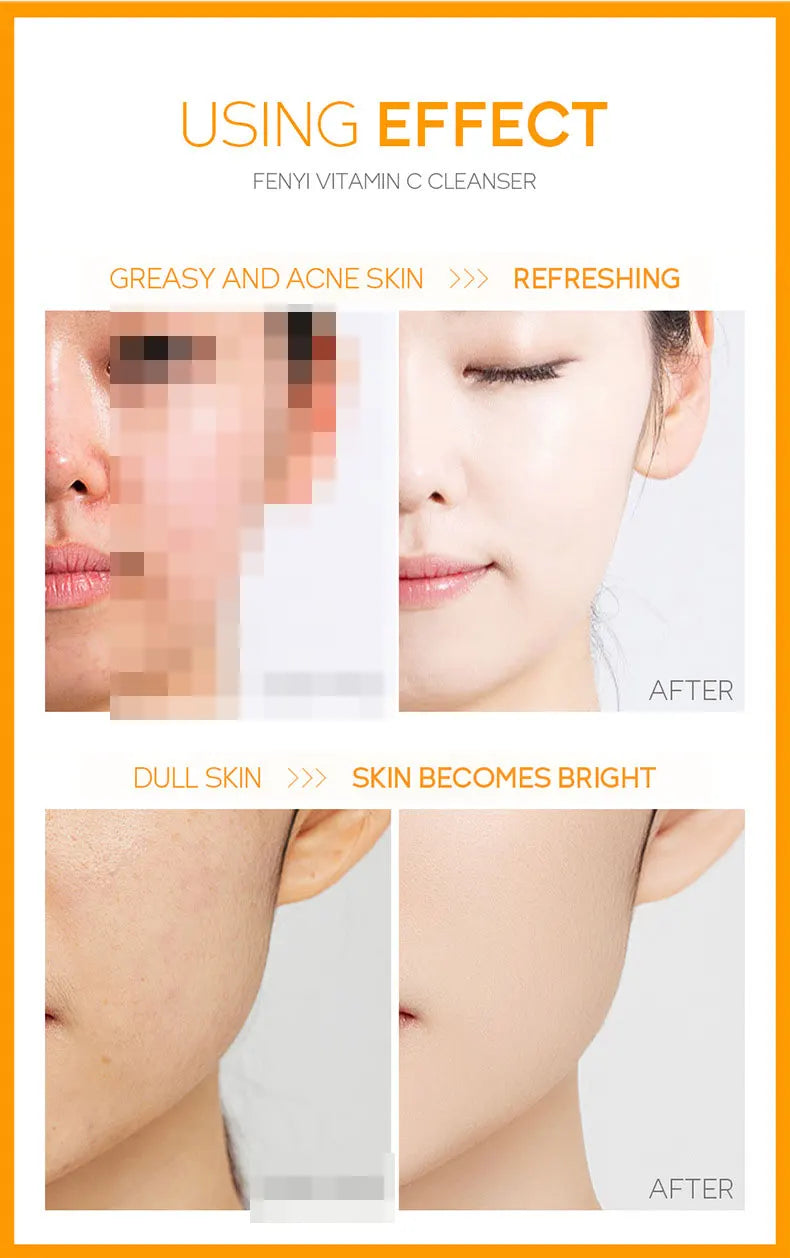 Vitamin C Facial Cleanser Skin Deep Cleansing Moisturizing Blackhead Removal Skincare Face Wash Foam Face Cleanser Skin Care