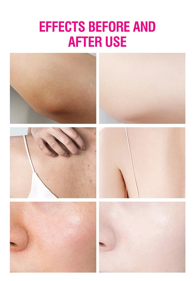 Body Lotion Whitening Moisturizing Dark Skin Bleaching Collagen Milk Face Body Cream Skin Care Body Leg Arm Lightening Smooth