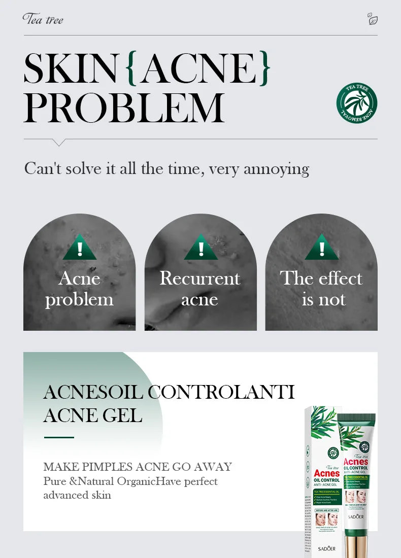 SADOER Tea Tree Acne Removing Cream Facial Skincare Oil Control Face Gel Creams Hydrating Moisturizing Facial Cream Skin Care