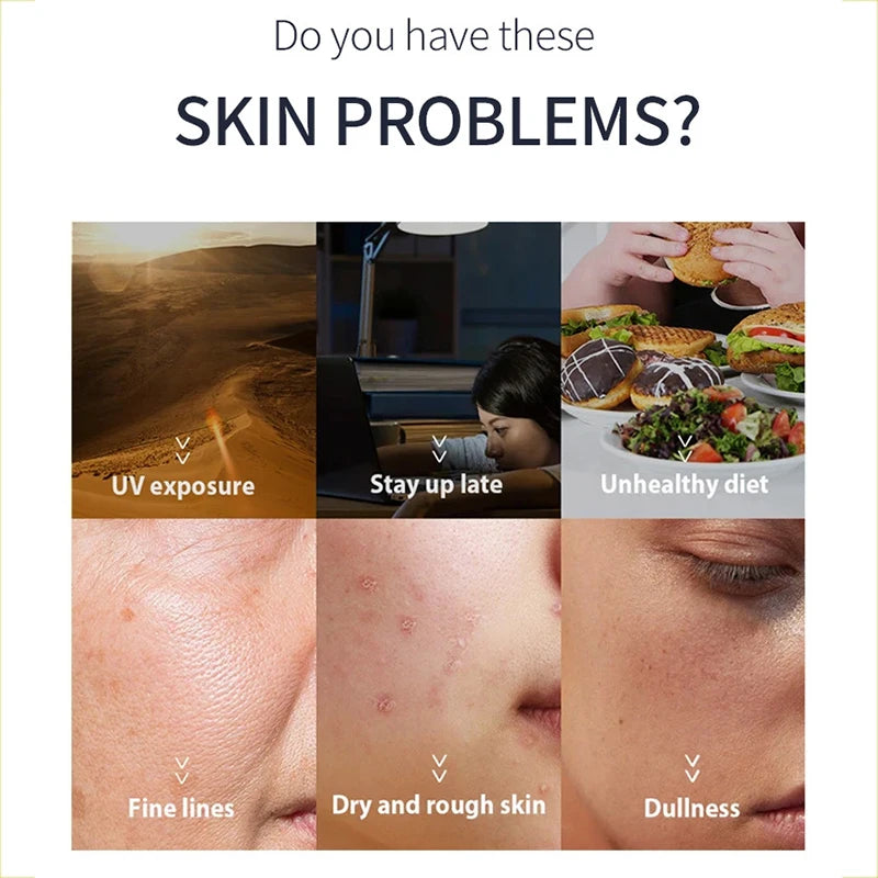 5pcs Collagen Sleeping Mask Set Hydrating Moisturizing Whitening Translucent Thin Smooth Tender Skin Nighttime Facial Care