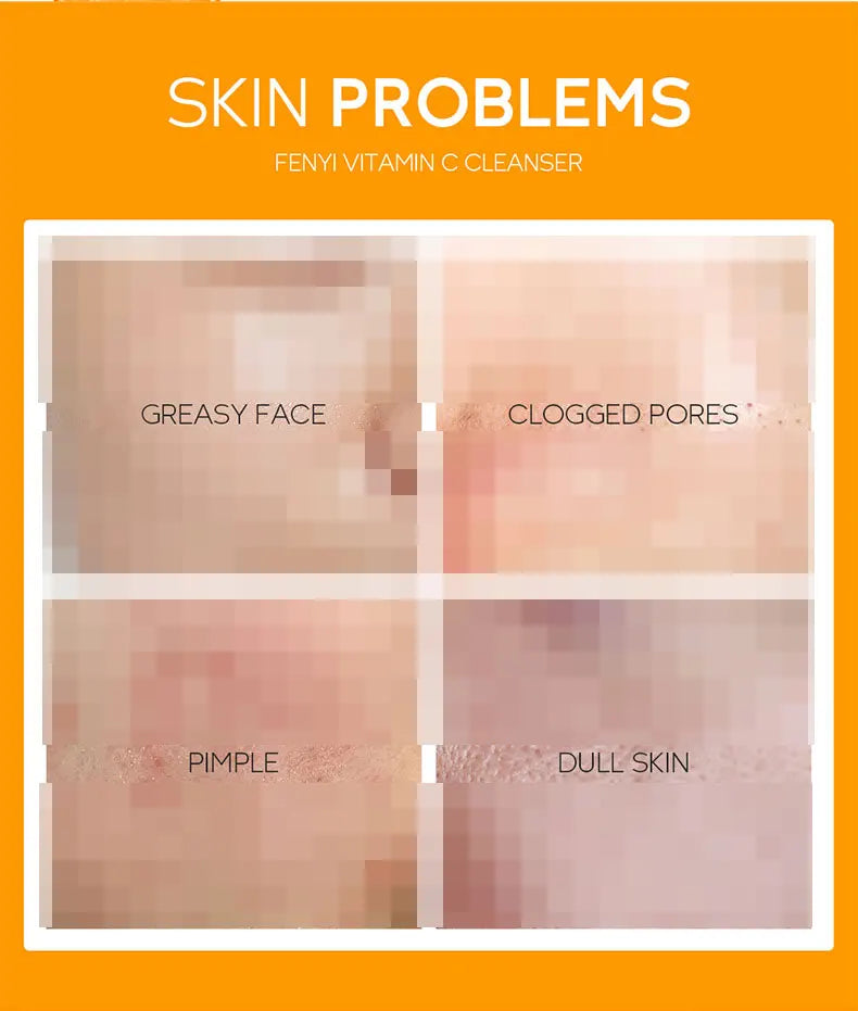 Vitamin C Facial Cleanser Skin Deep Cleansing Moisturizing Blackhead Removal Skincare Face Wash Foam Face Cleanser Skin Care