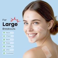 331 Patches Large Pimple Patches Hydrocolloid Acne Patch Skincare Blemishes Zit Breakouts Bandages Big Spot Covers for All Skin