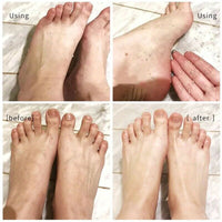 110ML Foot Cuticle Remove Dead Foot Exfoliator Softener Remove Dead Skin and Calluses Foot Mask Pedicure Nail Enhancer