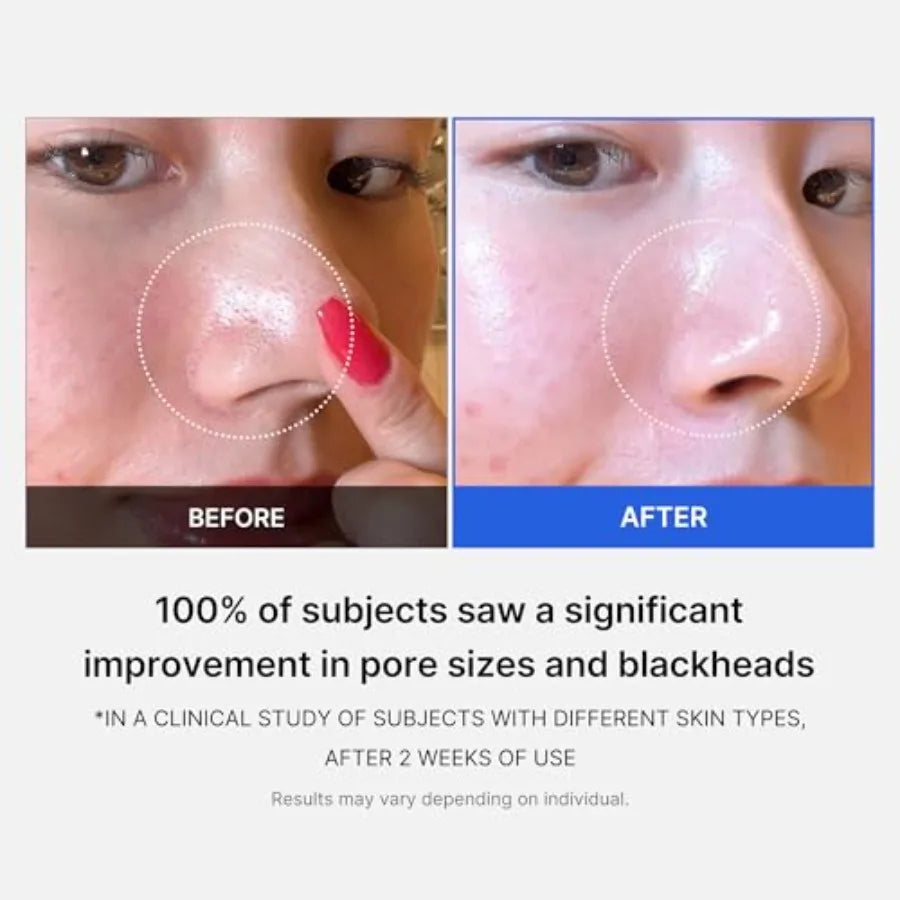 Medicube Zero Pore Pads 2.0 DualTextured Facial Toner Pads for Exfoliation and Pore Care with 4.5 AHA Lactic Acid 0.45 BHA Sali