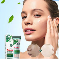 SADOER Tea Tree Acne Removing Cream Facial Skincare Oil Control Face Gel Creams Hydrating Moisturizing Facial Cream Skin Care