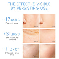 LAIKOU Milk Facial  Face Mask Shrink Pores Deep Hydrating Overnight Mask Moisturizing  Brightening Face Skin Care