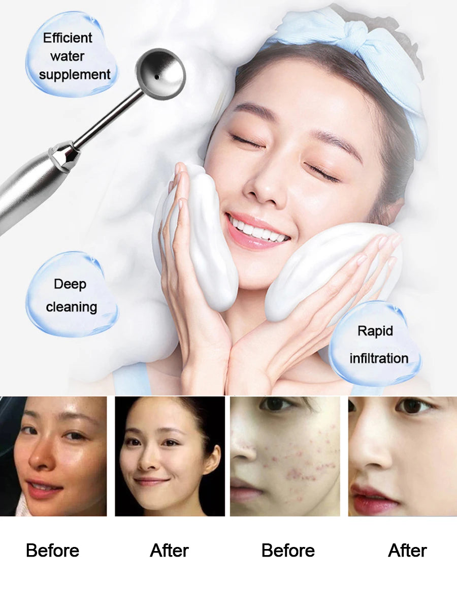 Rose Cleansing Bubble Water Active Oxygen Magic Solution For Automatic Machine Beauty Instrument Facial Skin Care Dropshipping