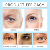 Eye Patches Dark Circles Puffiness with Hydrating Gel Technology Soothing Fine Lines Care for Sensitive Dry Skin Women 60 Pcs