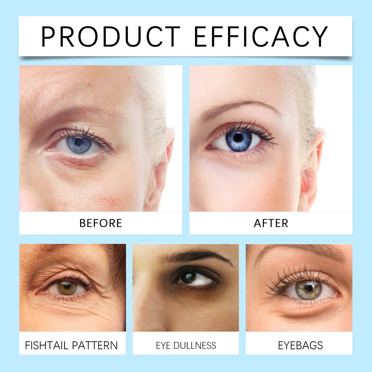 Eye Patches Dark Circles Puffiness with Hydrating Gel Technology Soothing Fine Lines Care for Sensitive Dry Skin Women 60 Pcs