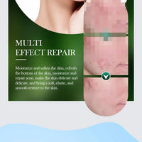 SADOER Tea Tree Acne Removing Cream Facial Skincare Oil Control Face Gel Creams Hydrating Moisturizing Facial Cream Skin Care