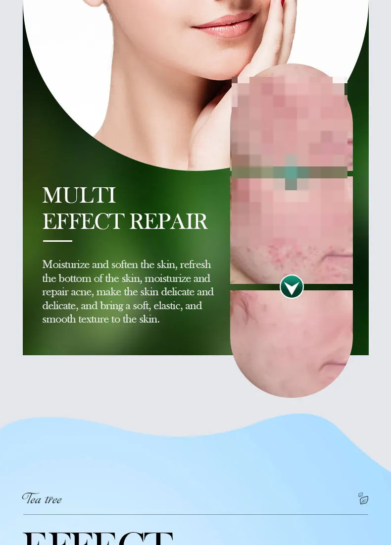 SADOER Tea Tree Acne Removing Cream Facial Skincare Oil Control Face Gel Creams Hydrating Moisturizing Facial Cream Skin Care