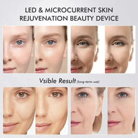 NEWEST Age Booster Pro Home Skincare Anti-aging Beauty Device Portable 5 Colors Light Therapy Essentials Acne Treatment Device