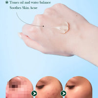 SADOER Tea Tree Acne Removing Cream Facial Skincare Oil Control Face Gel Creams Hydrating Moisturizing Facial Cream Skin Care