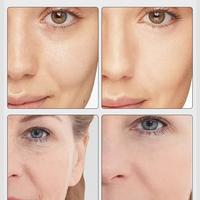 7 Colors EMS Microcurrent Facial Massager Age-R Booster Pro Anti Wrinkle Lift Device Home Use Beauty Tool for Skin Care & Rejuve