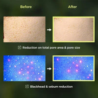 Korean Skin Care Centella Ampoule Face Wash Foam Cleanser Facial Pore Control  Makeup Gentle Cleansing Oil Original Skincare Set