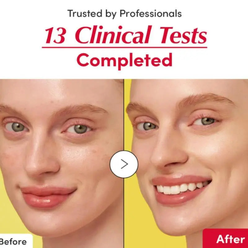 Deepcera Korean Skincare Bakuchiol Plumping Serum And Vitamin C Brightening Serum For Fading Acne Scars On The Face Skin Care