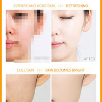 Vitamin C Facial Cleanser Skin Deep Cleansing Moisturizing Blackhead Removal Skincare Face Wash Foam Face Cleanser Skin Care