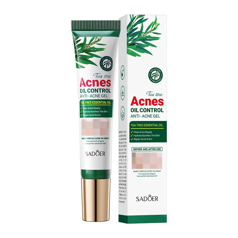 SADOER Tea Tree Acne Removing Cream Facial Skincare Oil Control Face Gel Creams Hydrating Moisturizing Facial Cream Skin Care