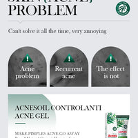 SADOER Tea Tree Acne Removing Cream Facial Skincare Oil Control Face Gel Creams Hydrating Moisturizing Facial Cream Skin Care