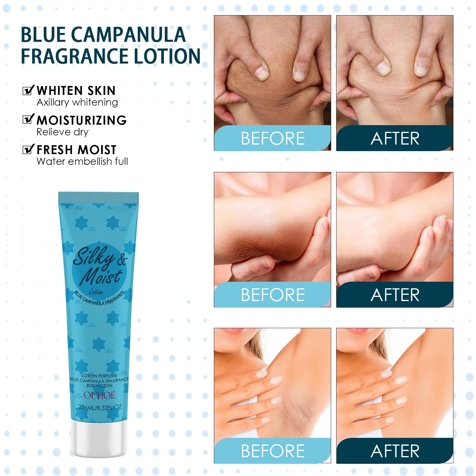 OUHOE Silky&Moist Lotion Body Lightening Armpit Knee Joint Dark Moisturizing Skin Whitening Body Beauty Care