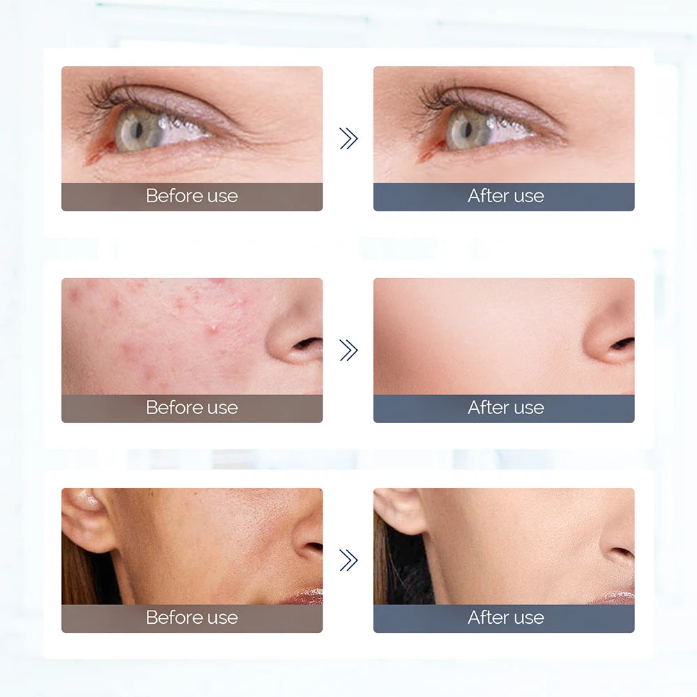 7 Colors LED Silicone Beauty Machine Skin Care Face Mask for Home Use