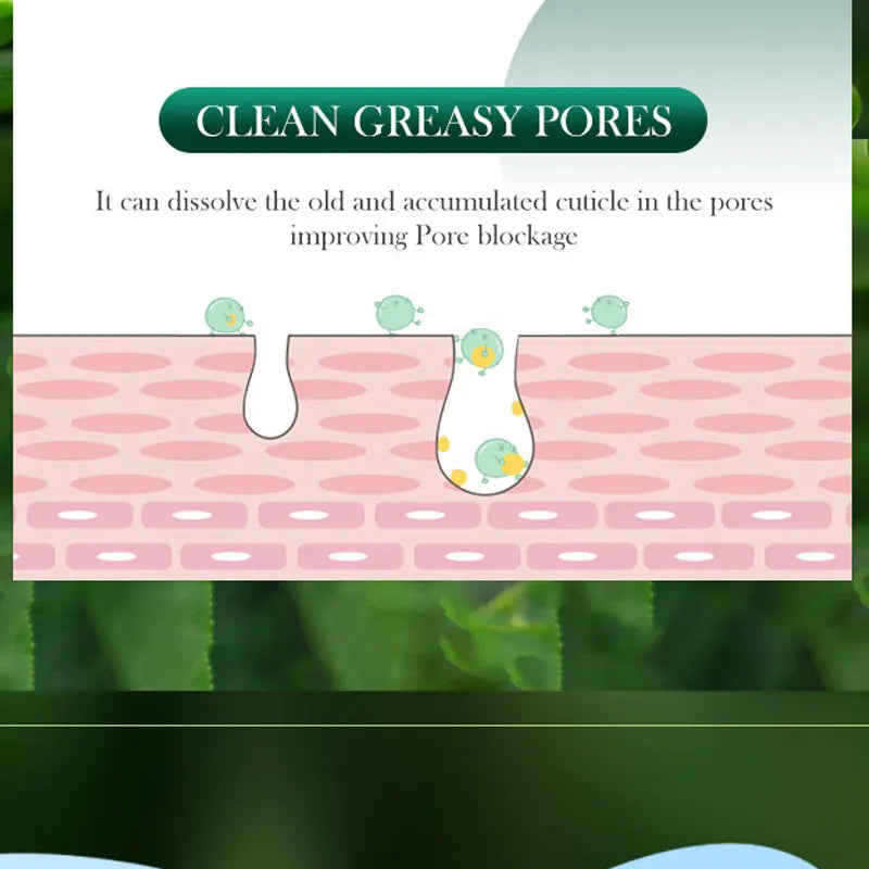 SADOER Tea Tree Acne Removing Cream Facial Skincare Oil Control Face Gel Creams Hydrating Moisturizing Facial Cream Skin Care